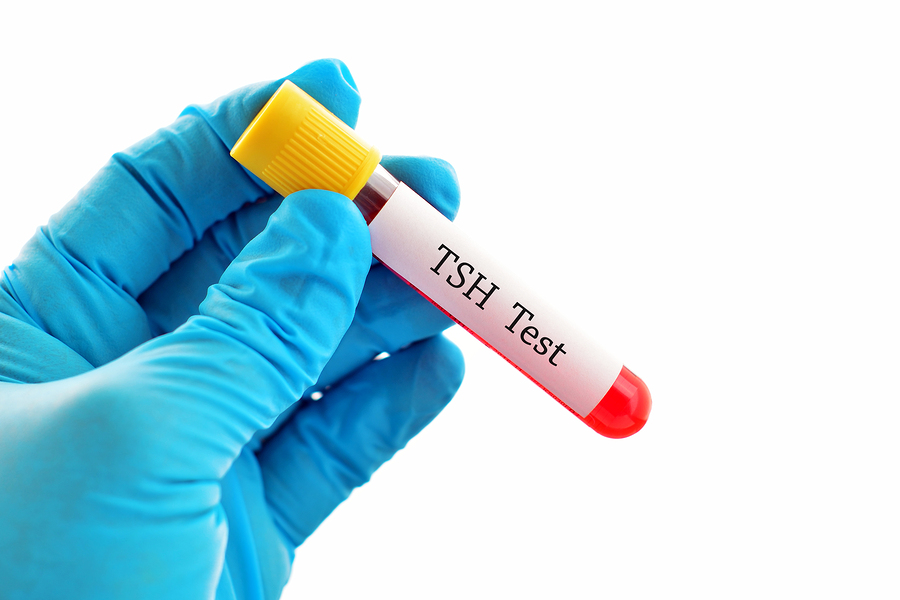 TSH blood test